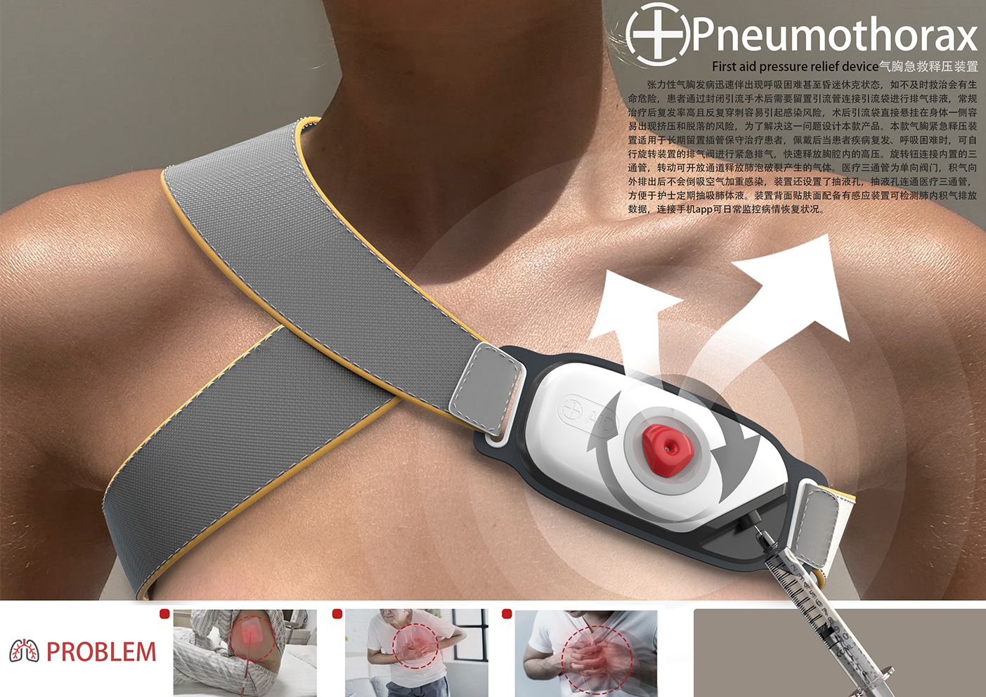 气胸急救释压装置